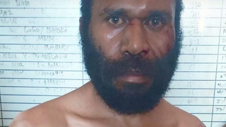 Ini Sosok Wabup Yalimo Erdi Dabi yang Tabrak Polwan di Jayapura hingga Tewas
