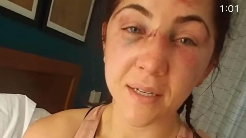 H-3 Minggu Menikah, Petarung UFC Cantik Ini Bonyok Dihajar Lawan