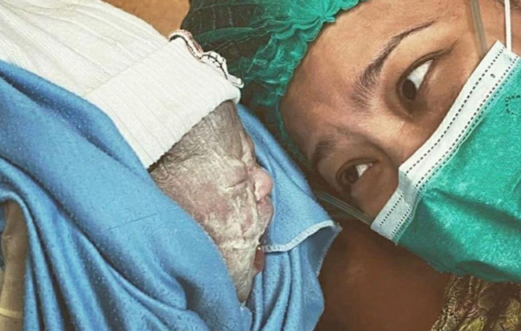 Alami Pendarahan Hebat Pascamelahirkan, Rachel Maryam Jalani Operasi Pengangkatan Rahim