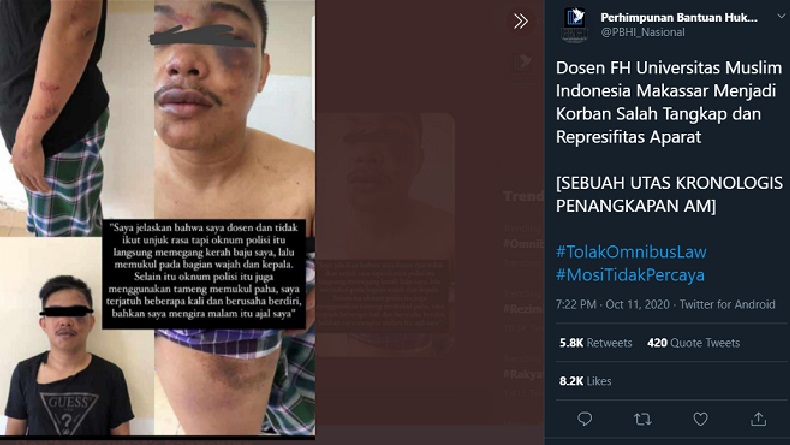 Viral, Dosen UMI Makassar Babak Belur Diduga Korban Salah Tangkap Polisi