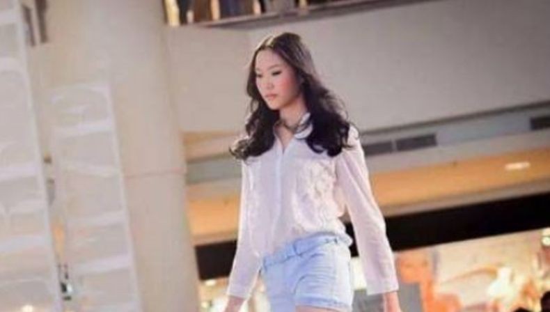 Model Cantik Ini Meninggal Dunia saat Sedot Lemak untuk Pernikahan