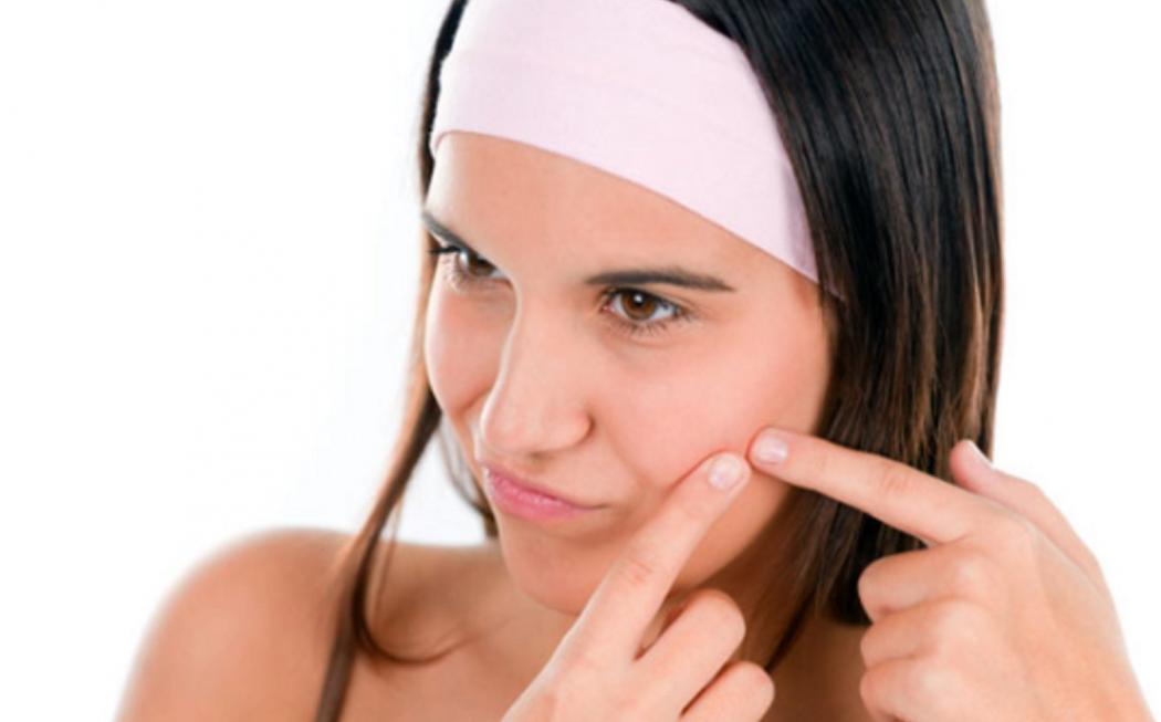 4 Cara Menghilangkan Bekas Jerawat Membandel Dengan Buah-buahan