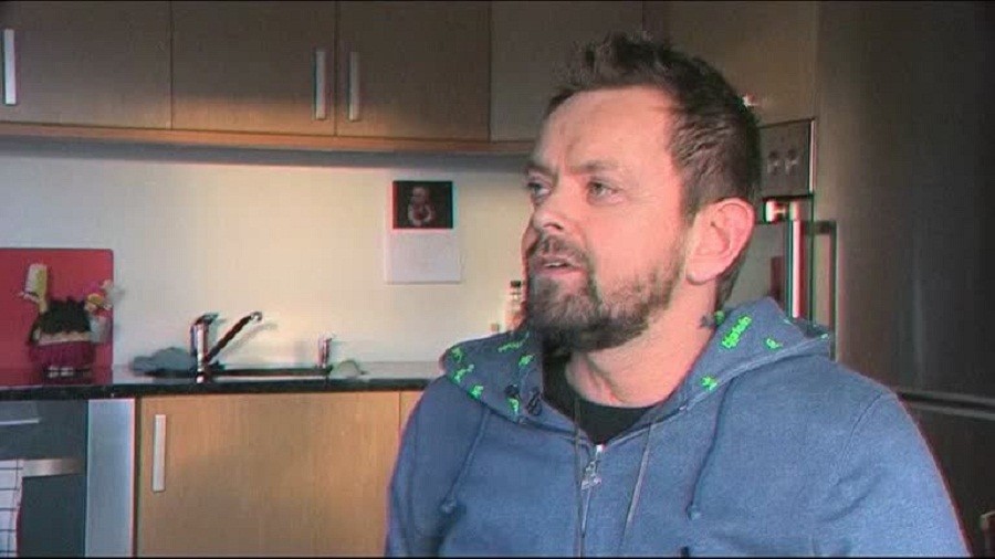 Operasi Sukses, Pria Ini Terima Cangkok 2 Lengan dan Bahu Pertama di Dunia