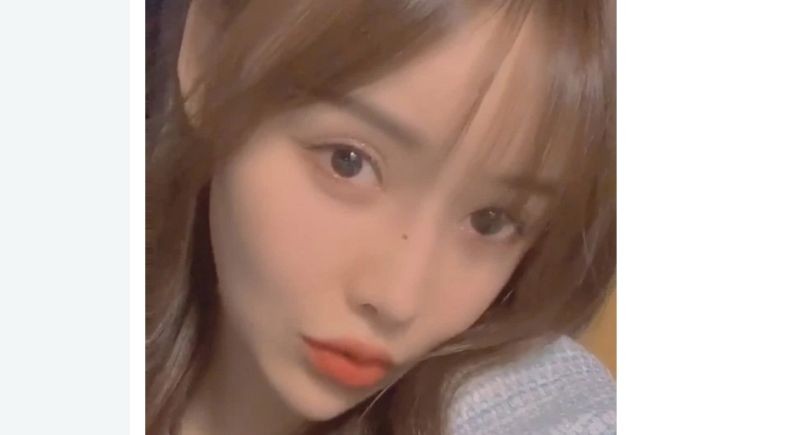 Duh, Wajah Aktris Cantik Ini Rusak Gara-Gara Kesalahan Operasi Plastik