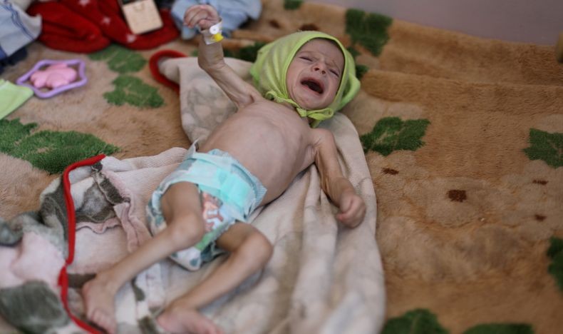 Miris, 400.000 Balita di Yaman Terancam Meninggal Tahun Ini karena Kelaparan