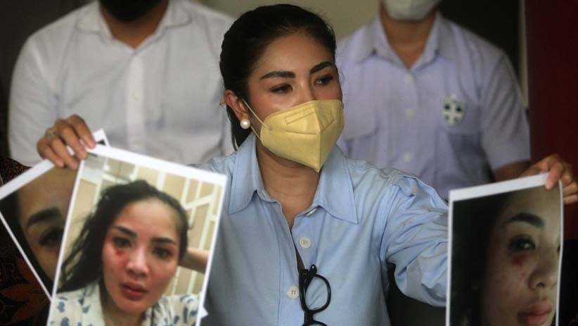 Kasus KDRT, Nindy Ayunda Ajak Teman Sebagai Saksi 