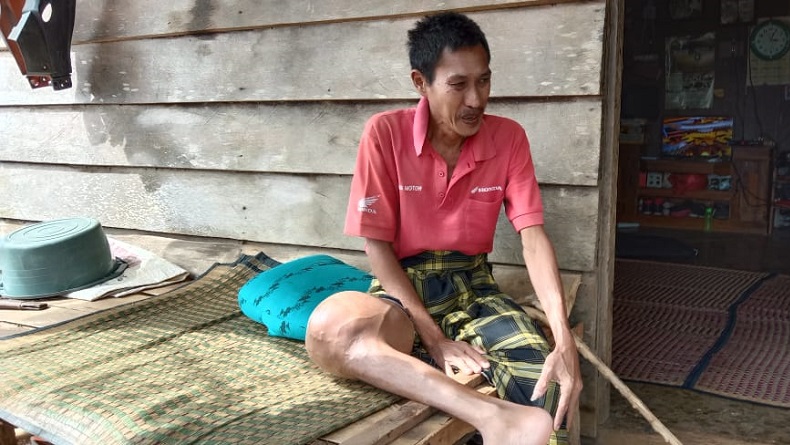 Punya Tumor di Kaki, Begini Cerita Pilu Petani Kopi di Pesisir Barat Lampung