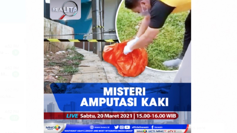Misteri Amputasi Kaki, Selengkapnya di Realita Sabtu Pukul 15.00 WIB 