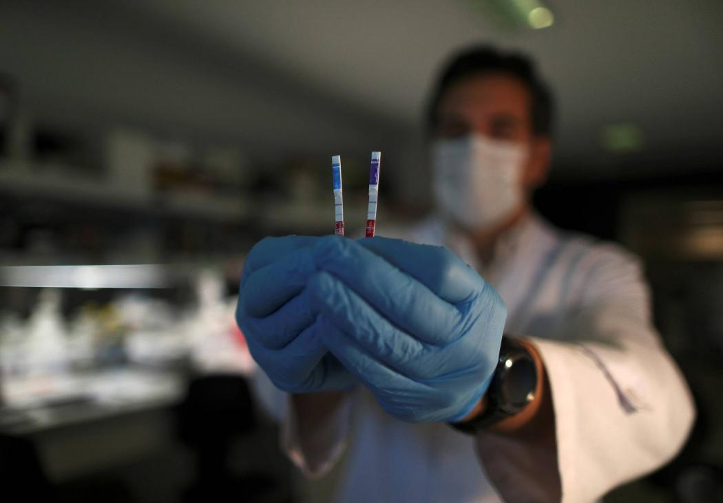 Jangan Keliru, Yuk Kenali 4 Jenis Tes Covid-19 yang Ada di Indonesia 