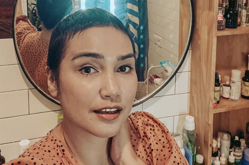 Idap Kanker Ovarium, Feby Febiola Sebut Tak Minta Didoakan Cepat Sembuh   