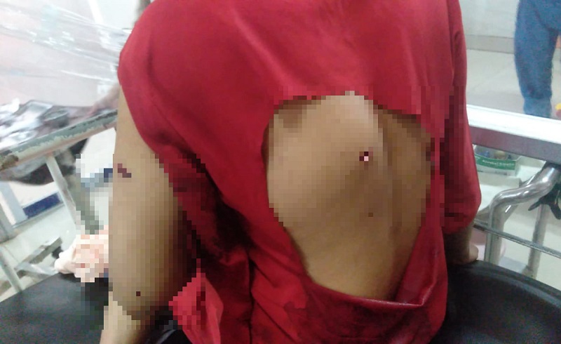 Usai Tusuk Istri karena Ribut, Pria di Bekasi Coba Bunuh Diri