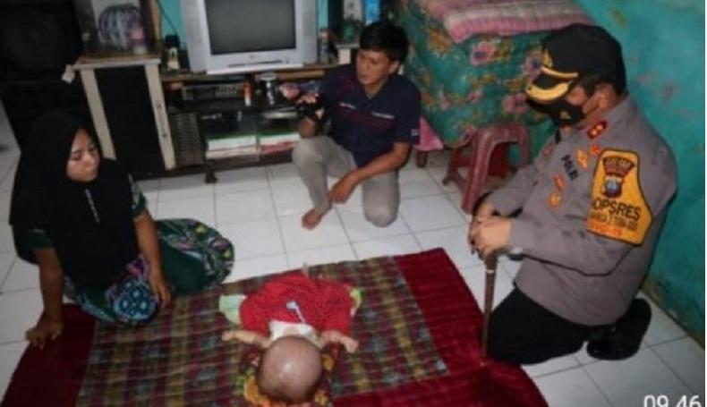 Kapolres Batubara Jenguk Bayi Hidrosefalus: Tidak Ada yang Mustahil bagi Tuhan