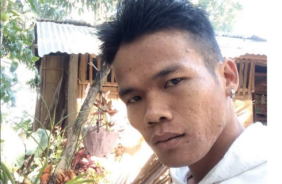 Ngeri! Pria Ini Tak Sadar Ada Pisau Nancap di Dadanya Setahun Lebih usai Ditikam