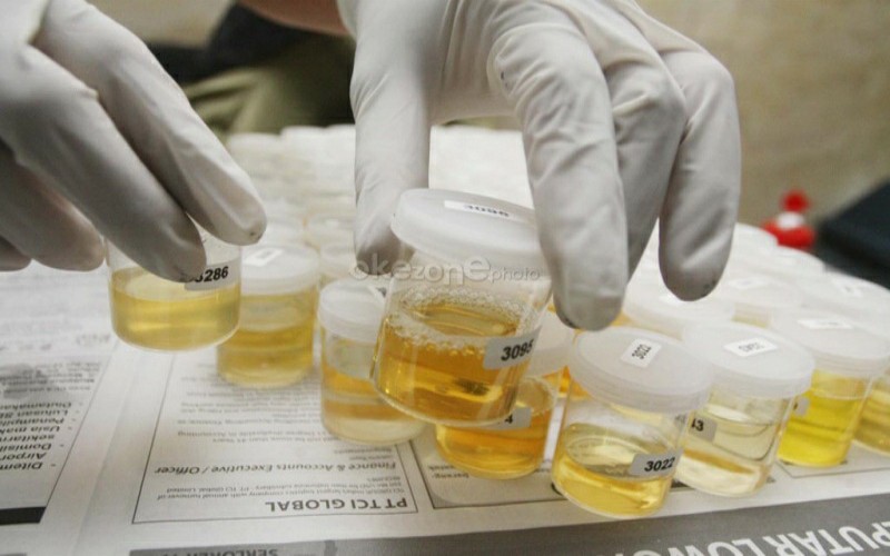 Tolak Narkoba, Pejabat di Palembang Jalani Tes Urine