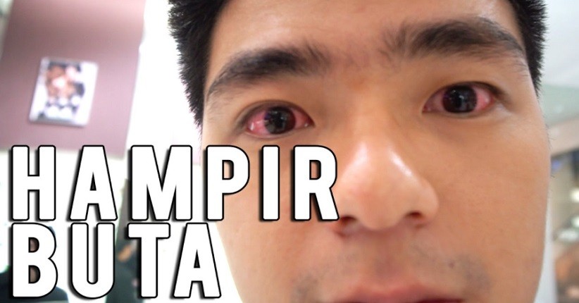 Pengalaman Menyeramkan Kevin Hendrawan saat Menggunakan Softlens