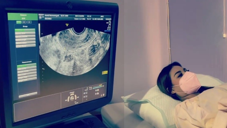 Kista Sudah Hilang, Aurel Hermansyah Siap Jalani Program Bayi Kembar Tiga