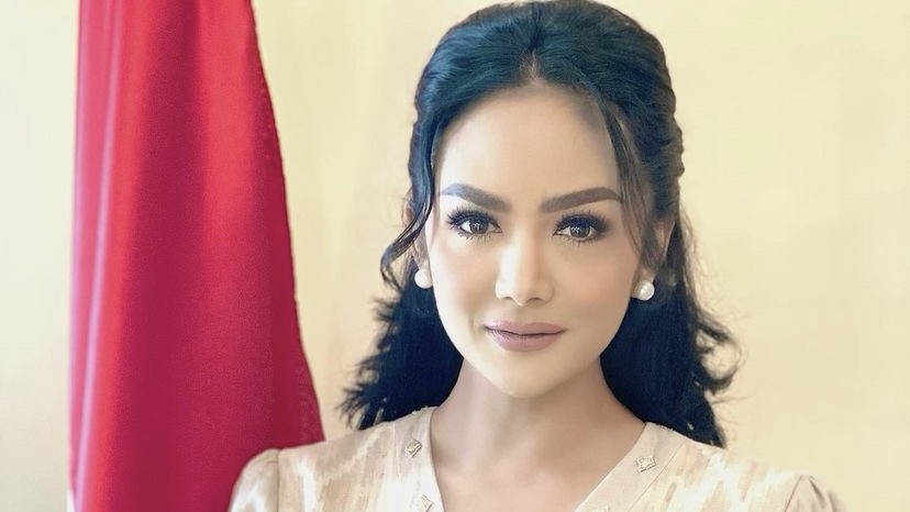 Aurel Hermansyah Punya Kista, Krisdayanti: Sudah Tahu dari Umur 16 Tahun