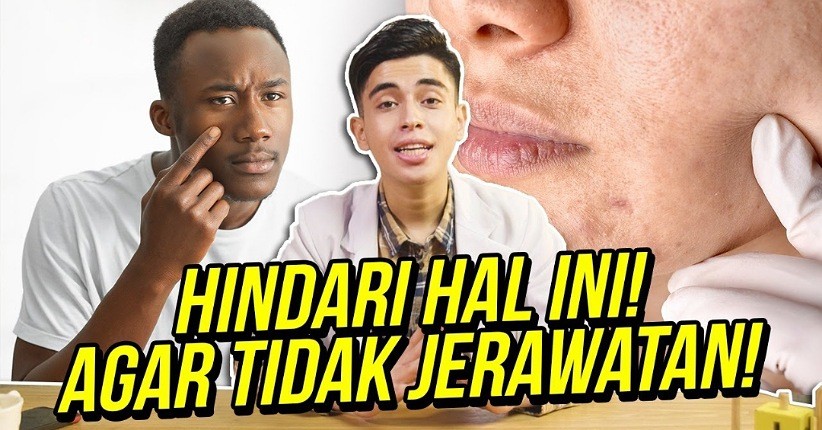 Makanan dan Minuman Ini Bisa Timbulkan Jerawat