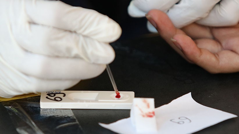 74 Pria Pesta Gay di Puncak Bogor, Dinkes Temukan Ada yang Reaktif HIV