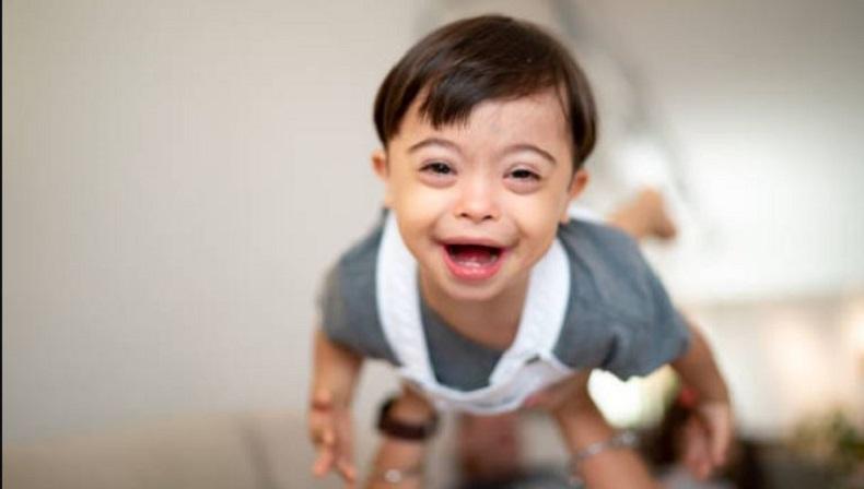 Jatuh dari Lantai 5 Apartemen, Balita Down Syndrome Ini Cuma Patah Kaki