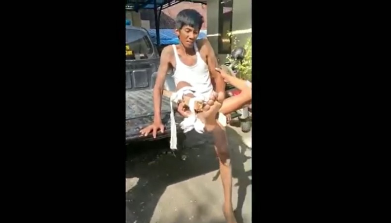 Pencuri Kotak Amal di Pura Bali Tertangkap, Kaki Patah Diamuk Massa 