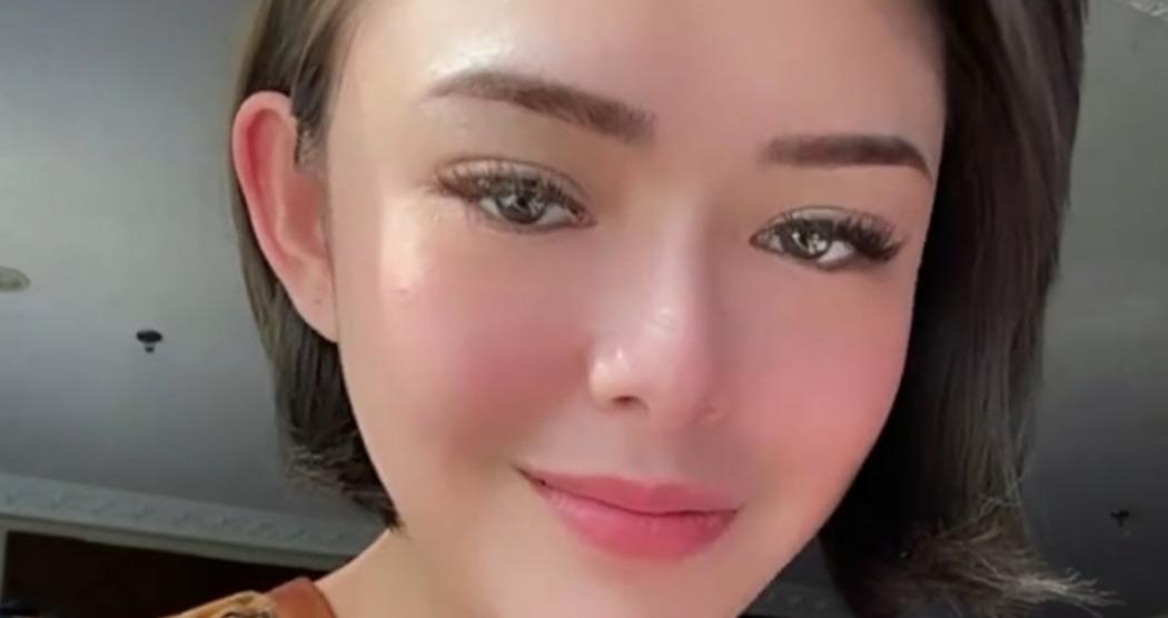 Amanda Manopo Bahas soal Atychiphobia, Ini Tebakan Netizen 