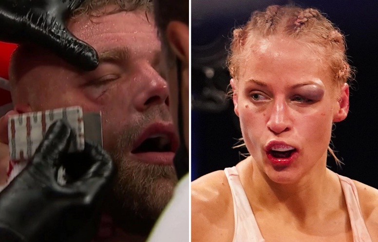 Ejek Mata Bonyok Petinju Billy Joe Saunders, Si Seksi Ebanie Bridges Dihujat