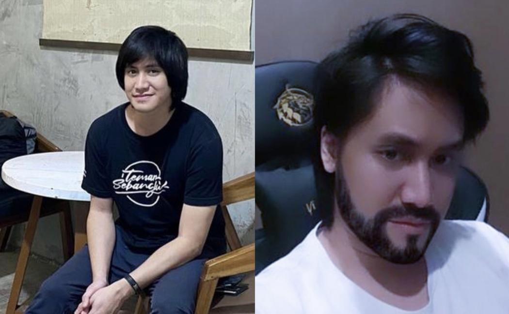 Mendekati Lebaran, Kevin Aprilio Pamer Tampilan Baru Usai Transplantasi Rambut ke Turki