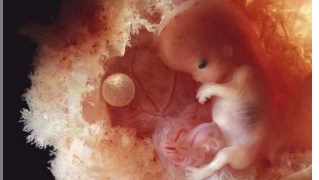 Ngeri.... China Kembangkan Kecerdasan Artifisial yang Dapat Merawat Janin di Rahim Buatan