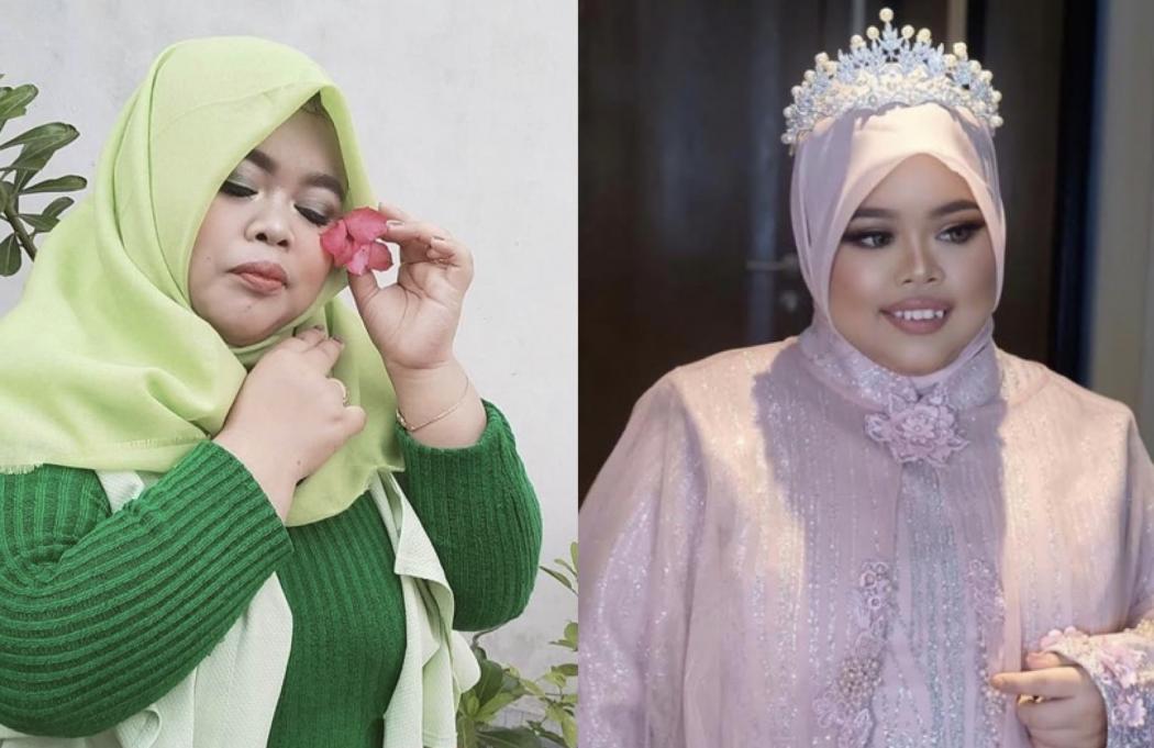 Intip Transformasi Kekeyi sebelum dan sesudah Filler Hidung, Netizen: Makin Cantik!