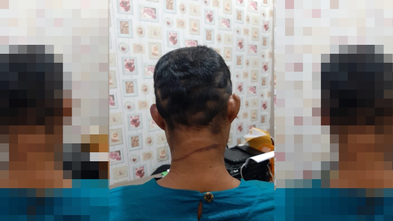 Tega, Suami di Banyuasin Masukan Cobek ke Kemaluan Istrinya
