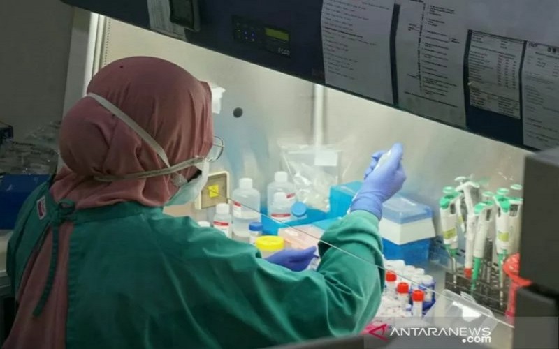  Percepat Hasil Pemeriksaan Sampel Covid-19, Ini yang Dilakukan Dinkes Sumsel 