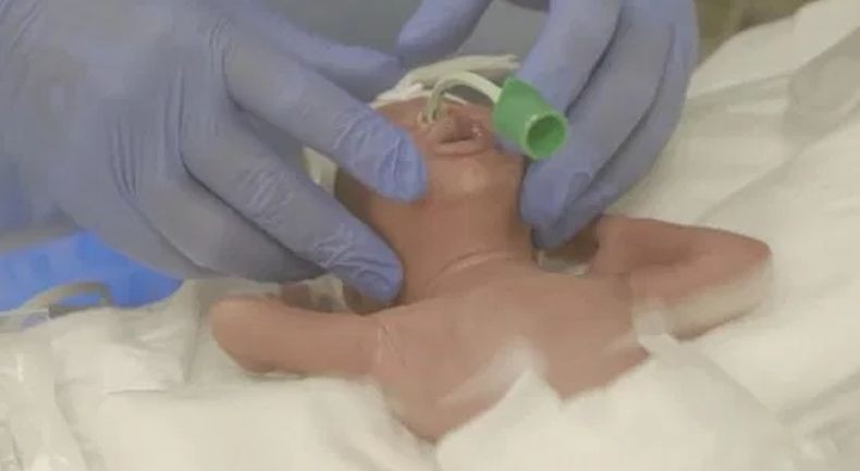 Rekor, Perempuan Ini Lahirkan Bayi Kembar 10