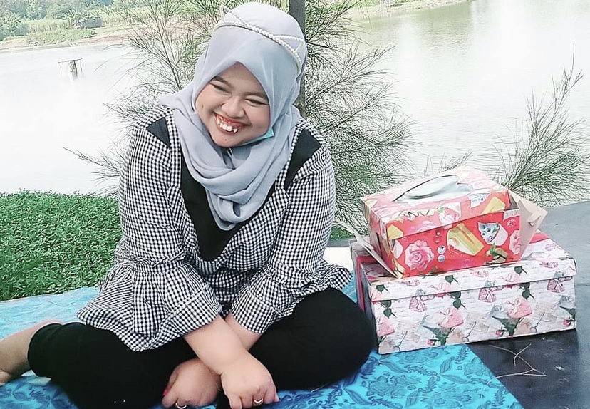 Didesak Pasang Kawat Gigi, Kekeyi Tolak dengan Tegas: Gigiku Langka   