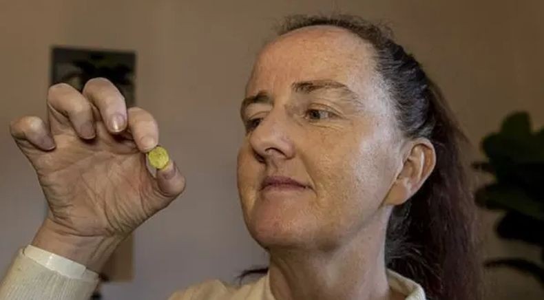 Mainan Tertinggal di Hidung Perempuan Ini Selama 37 Tahun, Terungkap karena Tes Swab