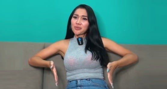 Operasi Rambut, Lucinta Luna Sempat Dibotaki demi Jadi Perempuan Sempurna