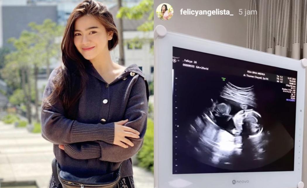 Hamil 5 Bulan, Felicya Angelista Masuk Rumah Sakit dan Jalani Tindakan