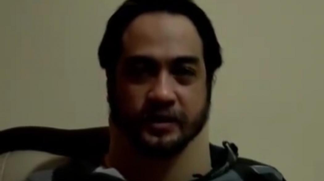 Pecah Pembuluh Darah di Kepala, Begini Kondisi Ferry Irawan Saat Ini