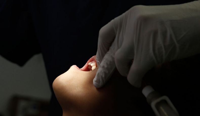 Pria Ini Meninggal Setelah Cabut Gigi, Kenapa?