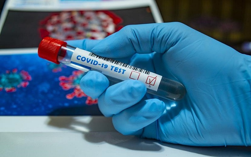 Sulut Catat Rekor Kasus Positif Covid-19, Total 21.757 Orang dan Sembuh 16.955