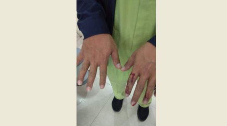 Jadi Korban Amukan Keluarga Pasien Covid-19, Perawat RSUD Ambarawa Lapor Polisi 