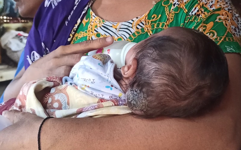 Bayi Penderita Tumor Otak di Puncak Jeringo Lotim Akhirnya Dapat Bantuan