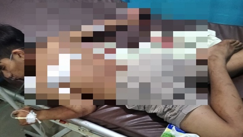 Pria di Manado Sekarat dengan 6 Tusukan di Tubuh, Pelaku Masih Diburu Polisi