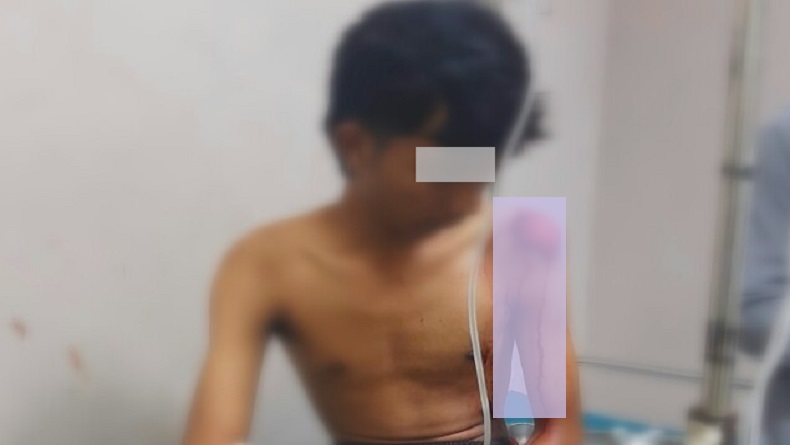 Tawuran Antarpelajar Pecah di Parungkuda Sukabumi, 1 Tewas