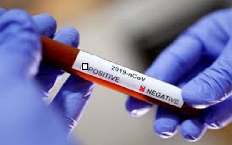 Update Kamis 26 Mei 2022 : Kasus Positif Covid-19 Tambah 246 Orang