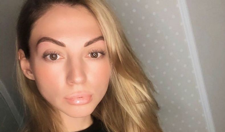 Tragis, Influencer Cantik Ini Meninggal saat Operasi Plastik Ubah Bentuk Hidung