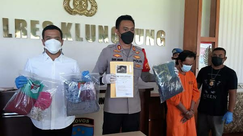 Berdalih Buktikan Tak Mandul, Ayah di Bali Setubuhi Anak Angkat hingga Hamil
