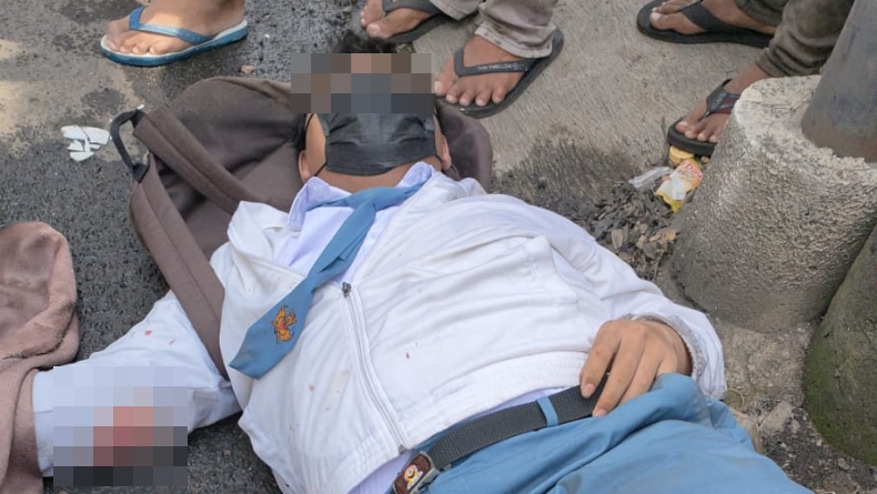 Ditabrak Truk, Pelajar di Pondok Aren Patah Kaki