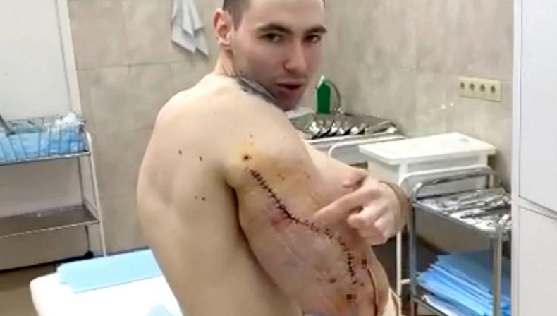 Waduh, Manusia Popeye Berotot Kekar Ini Terancam Kehilangan Nyawa