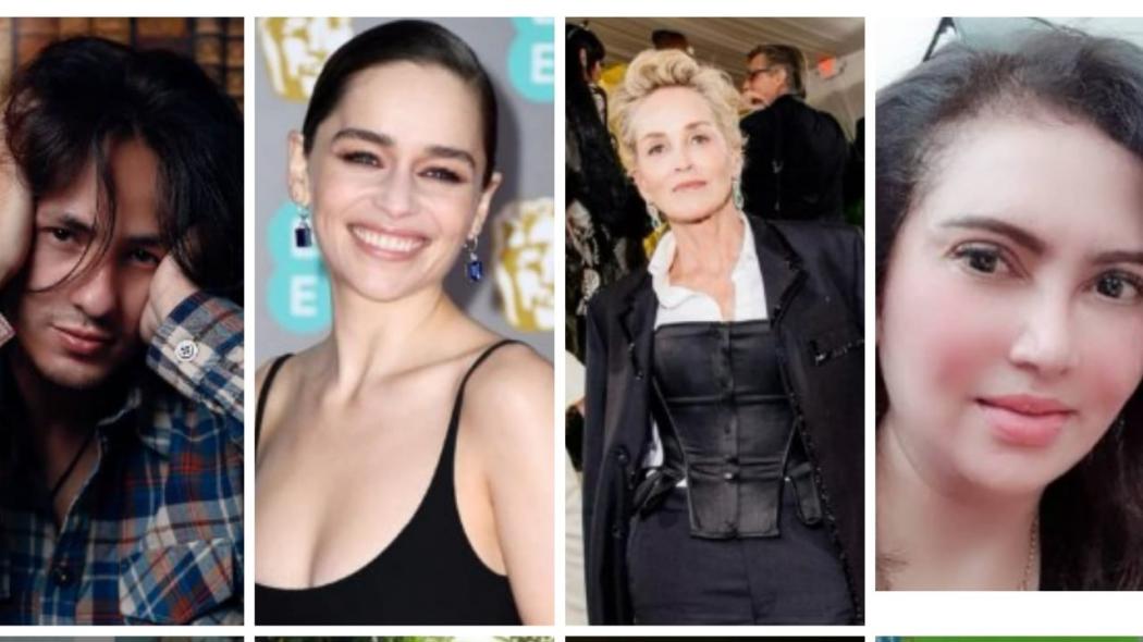 4 Artis Pernah Alami Pendarahan Otak, Gangguan Kesehatan yang Kini Menimpa Tukul Arwana